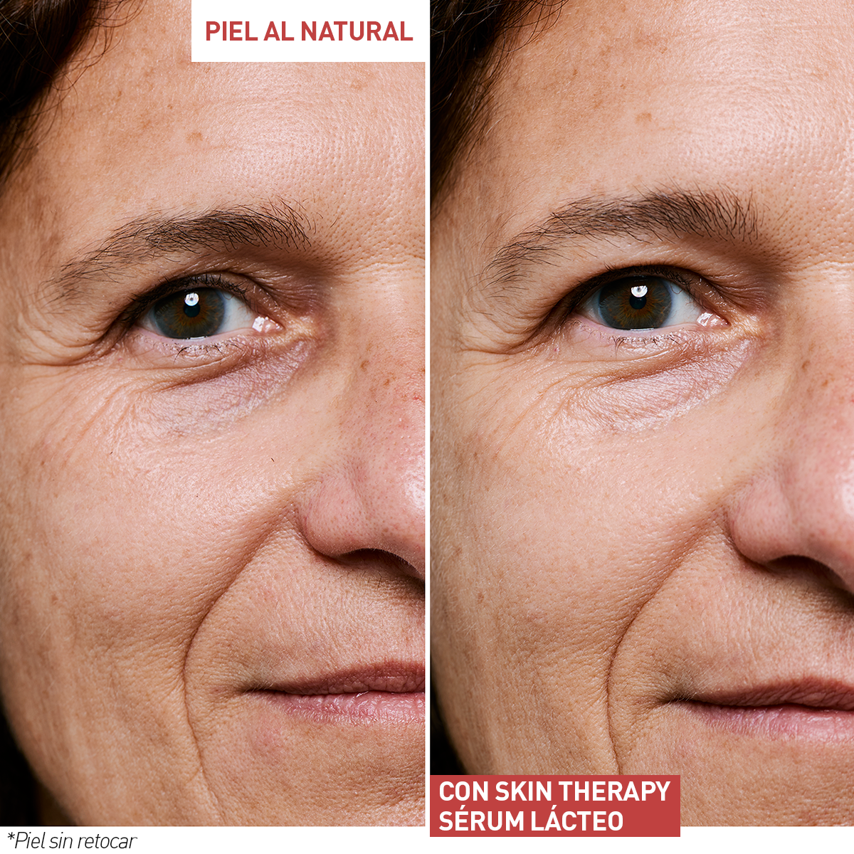 Vista zoom 5/10 de Skin Therapy Sérum Lácteo, , ES